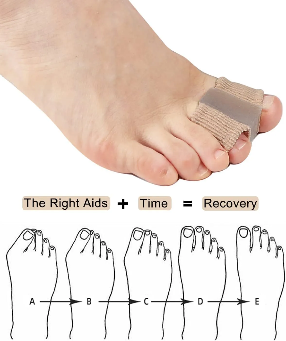 Bunion Toe Separators for Overlapping Toes Women Men, Gel Toe Spacers Bunion Corrector with 2 Loops for feet (12PC)
